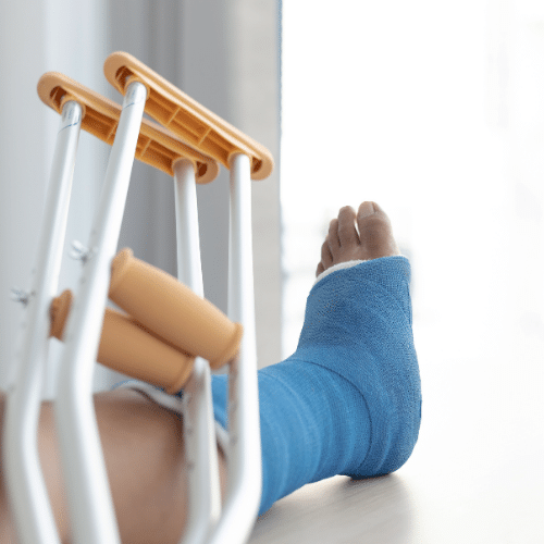 how long do i have to file an amputation claim