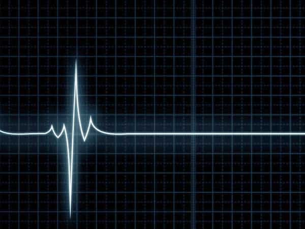 Hart stop after injury